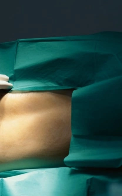 Surgery to Fix Recurrent Hernias​