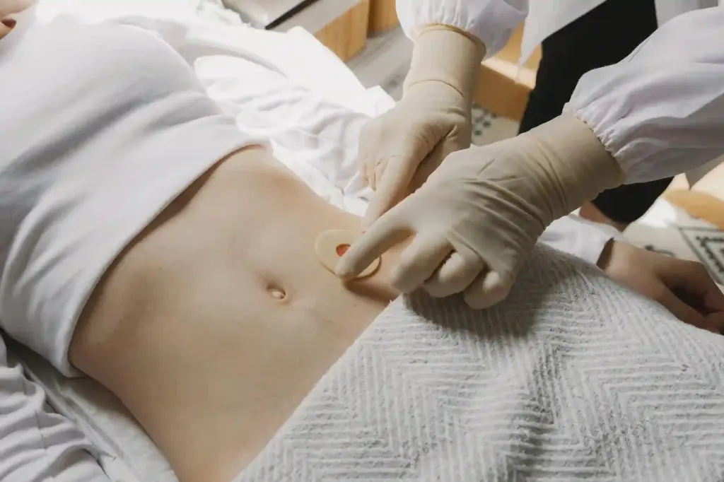 What are the Types of Umbilical Hernias